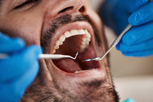 Best Walk-In Emergency Dental Services in Pigeon, MI
